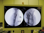 Small 32a opt