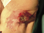 Small foto 2 opt