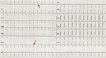 Small ryc 3 1 opt