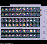 Small ryc 1 opt