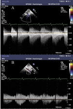 Small ryc 1 opt