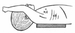 Small rycina 3 opt
