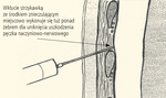 Small 25239