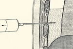 Small 25248