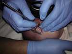 Small ryc 1 opt