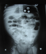Small ryc 2 opt