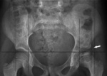 Small ryc 6 opt