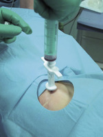 Small ryc 4 opt