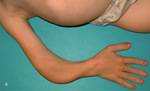 Small 25603