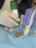 Small rycina 4 opt