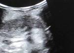 Small rycina 5 opt