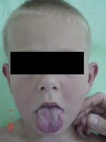 Small szenborn ryc 2 opt