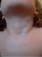 Small 25754