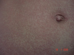 Small szenborn ryc 9 opt