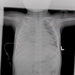 Small strzelak ryc2 opt