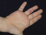 Small batko ryc.1 opt