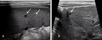 Small batko ryc.4 opt