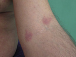 Small ryc3 opt
