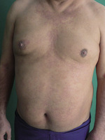 Small ryc1 opt