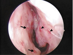Small nejm 786 opt