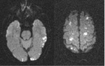 Small ryc 3 opt