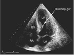 Small ryc 4 opt