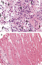 Small ryc 5 opt