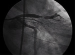 Small ryc.3 opt