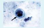 Small ryc 2 opt
