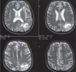 Small ryc 3 ong opt