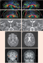 Small ryc 3 nejm opt