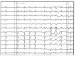 Small ryc 5 opt