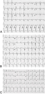 Small f6.large opt