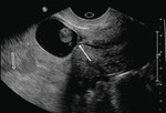 Small 4b opt