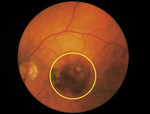 Small image001 opt