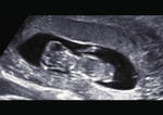 Small 1 opt