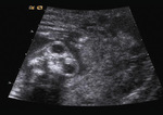 Small 11 opt