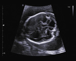 Small 13 opt
