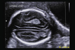 Small 16 opt