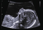 Small 17 opt