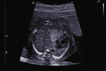 Small 21 opt