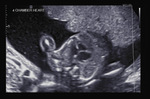 Small 22 opt