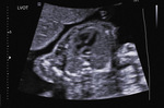Small 23 opt