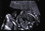 Small 24 opt