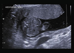 Small 25 opt