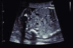 Small 27 opt
