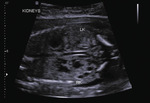 Small 28 opt