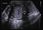 Small 29 opt