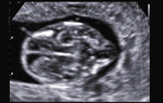 Small 3 opt