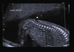 Small 30 opt